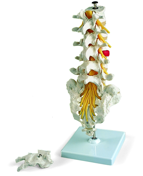 Lumbale wervelkolom: trauma