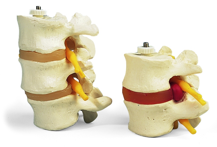 Lumbale wervelkolom: flexibel model
