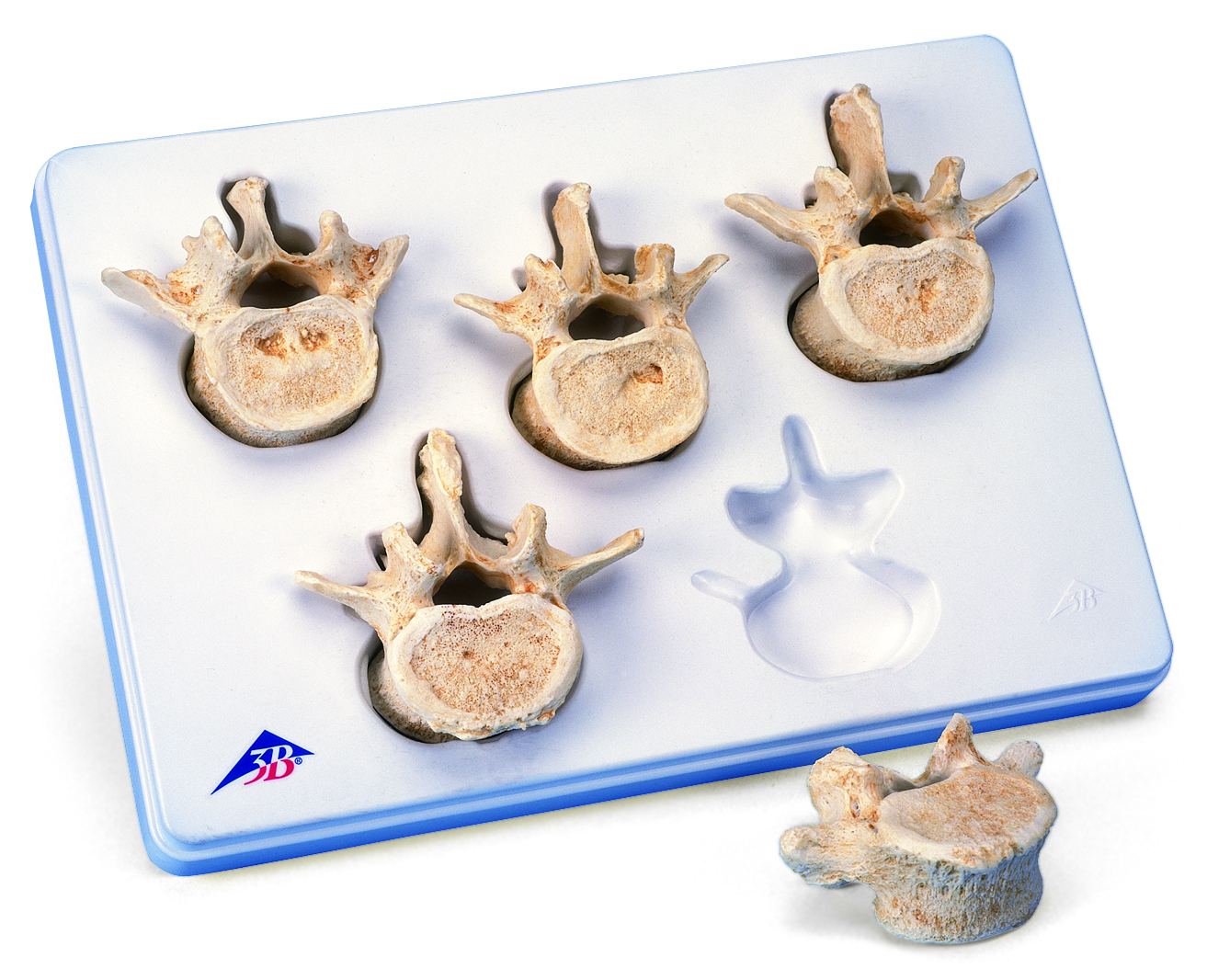 Lumbale wervelset 5-delig 3B BONElike ™